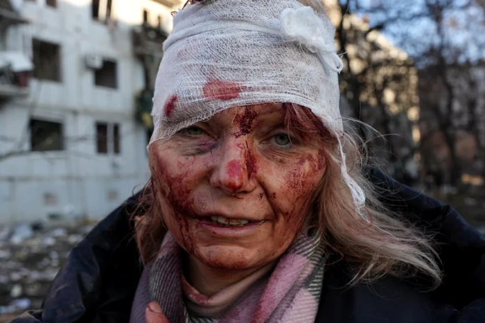 O femeie rănită fotografiată după atacul aerian de la Harkov Credit: GETTY Images
