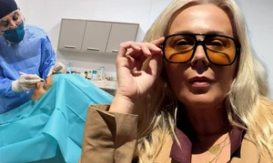Cum se simte Dana Săvuică după operația de blefaroplastie superioară