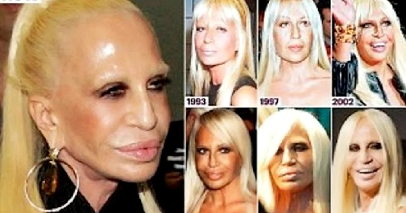 Designerul italian a devenit dependent de botox şi liftinguri faciale FOTO: Daily Mail