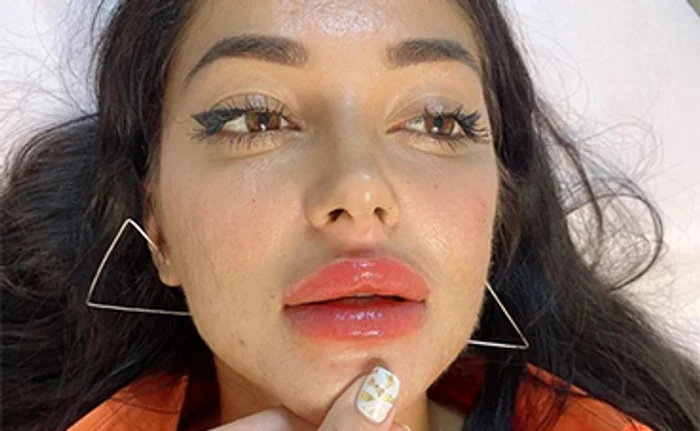 Elena Ionescu: ”Ador buzele cu volum!”