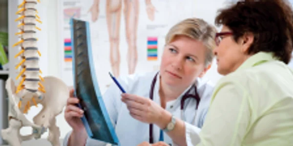 Osteoporoza poate produce tasări vertebrale şi fracturi care curbează coloana 