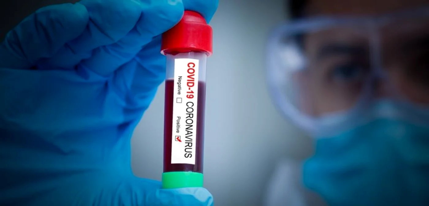 Peste 670 de persoane s-au vindecat d einfecţia cu COVID-19 FOTO Shutterstock