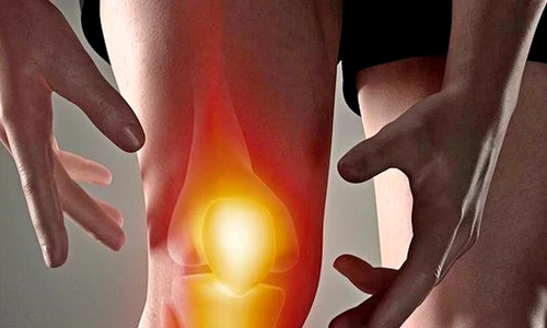 coxartroza tratament jpeg