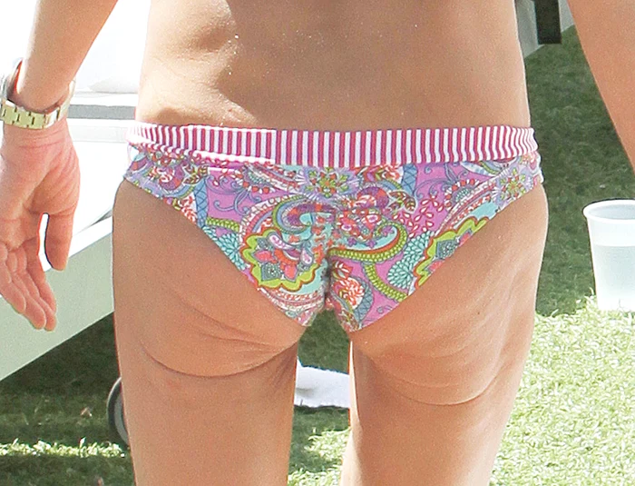 2015 - Are trupul plin de riduri şi vergeturi