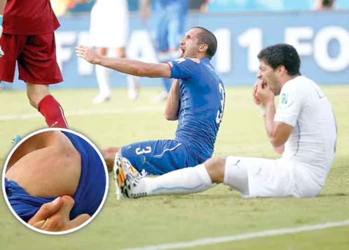 Cât costă muşcătura lui Suarez