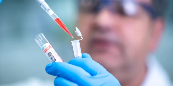 Un angajat al companiei germane de biotehnologie Qiagen demonstrează cum se aplică un test de coronavirus în Hilden Germania 11 martie 2020 FOTO  Sascha Schuermann/Getty Images