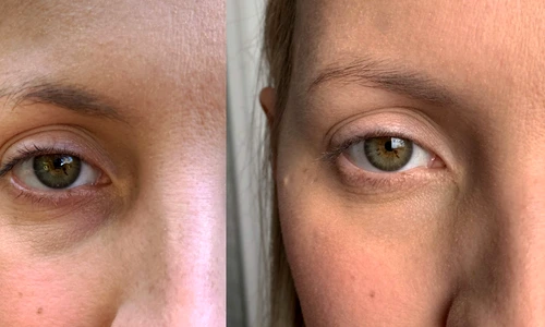 1 85177 original jpg jpeg