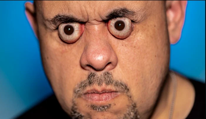 Williams Lopez își poate scoate ochii din orbite până la 19 mm (Foto: Guinnness World Records)