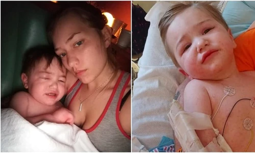 1 copil in coma dupa ce a fost muscat de capusa jpg jpeg