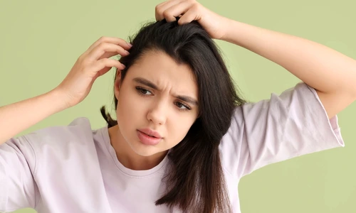 Semne ca parul nu este spalat suficient  Sursa foto shutterstock 2439069399 jpg