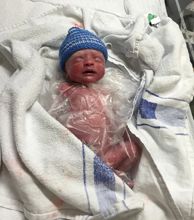 Doctorii l-au pus pe micuț într-o pungă de plastic