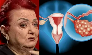 semnele cancerului ovarian jpg