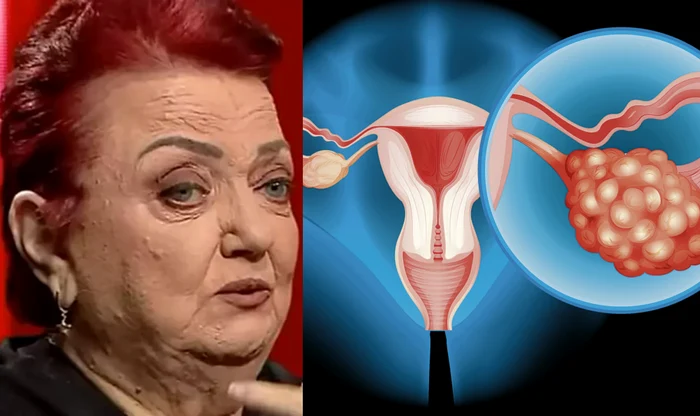 semnele cancerului ovarian jpg