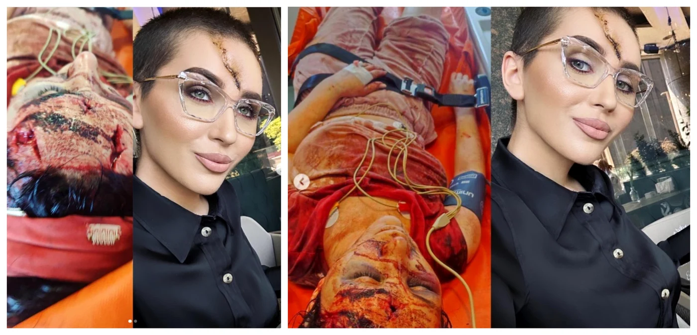 Dana Roba, imaginile necenzurate din noaptea cumplită / Sursă foto: Instagram