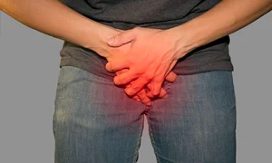 fractura penis jpeg
