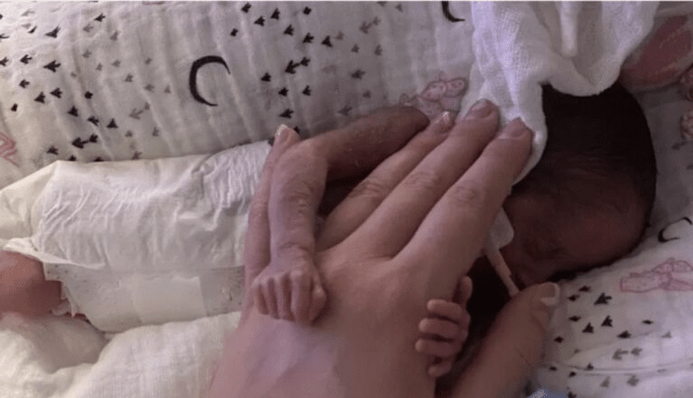 Povestea uimitoare a fetiței născute prematur la 5 luni și jumătate. Avea 515 grame, dar a supraviețuit