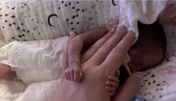 Imogen, fetița venită pe lume la doar 5 luni și jumătate FOTO Rachel Stonehouse