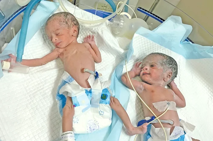 Gemenele au venit pe lume perfect sănătoase