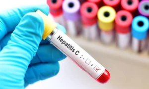 1 hepatita c jpg jpeg