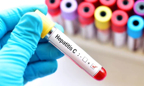 1 hepatita c jpg jpeg