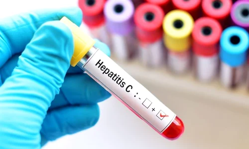 1 hepatita c jpg jpeg