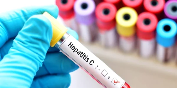 1 hepatita c jpg jpeg