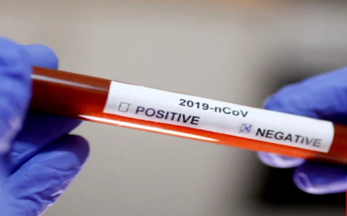 
    Lotul și staff-ul echipei U21 a României a fost testat înaintea plecării în Spania  