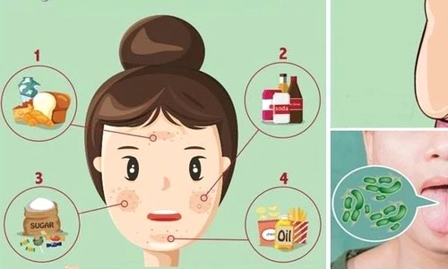 Toxine in organism  jpeg