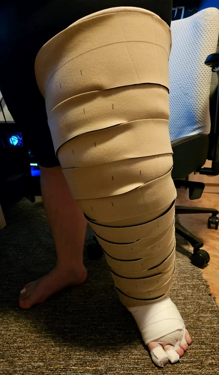 Picioarele lui Gabriel FOTO Facebook/Cămara lui Gabriel