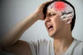 1 accident vascular cerebral jpg jpeg