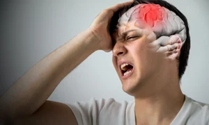 1 accident vascular cerebral jpg jpeg