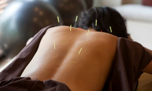 1 clicksanatate ro acupunctura jpg jpeg