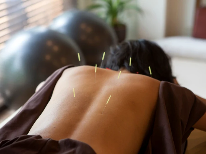 1 clicksanatate ro acupunctura jpg jpeg