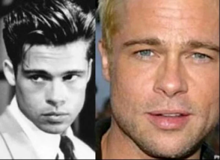 brad pitt operatie estetica