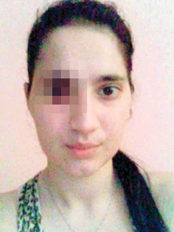 Aşa arată acum Daniela Borz, tânără împuşcată în ochi cu un pistol cu bile din cauciuc