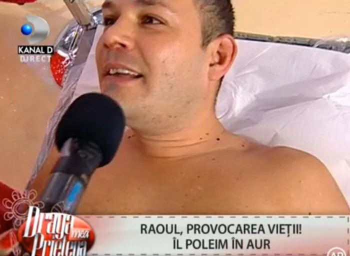 Anul acesta, Raoul şi-a făcut implant de păr