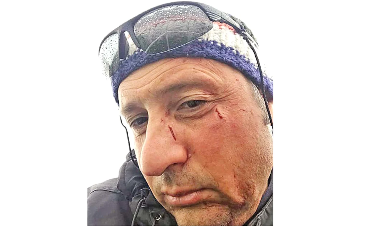 
    Daniel Petrescu, tulceanul atacat de huliganii beţi  