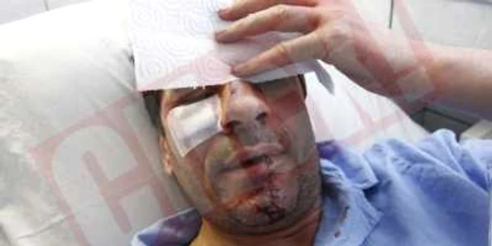 Stelian Ogică, internat în spital