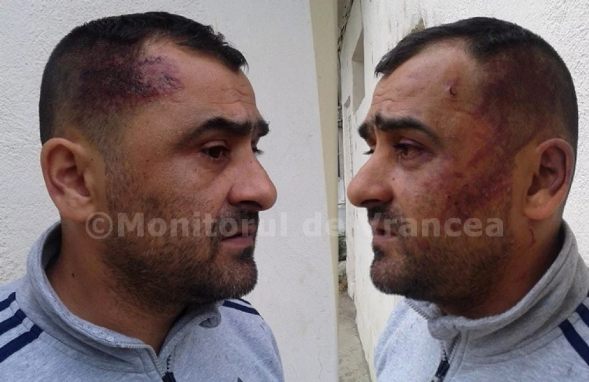 Orlando Şerbănică a fost lovit de mai multe persoane foto: monitorulvn.ro