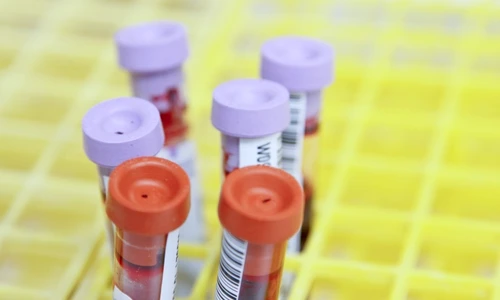 1 teste pentru covid 19 jpg jpeg