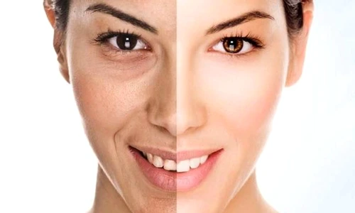 1 82956 original jpg jpeg