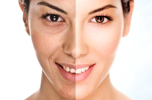 1 82956 original jpg jpeg