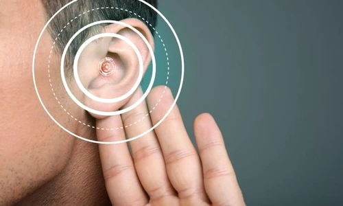 1 audiograma jpg jpeg