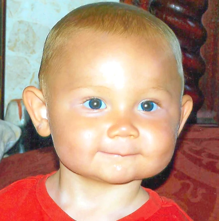 
    6 luni- Băieţelul a  devenit  brusc portocaliu  după ce a mâncat  pastă de morcovi  