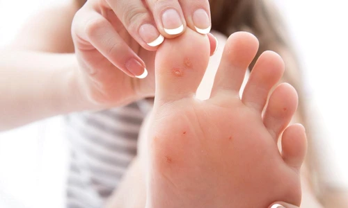 1 negi in talpa jpg jpeg