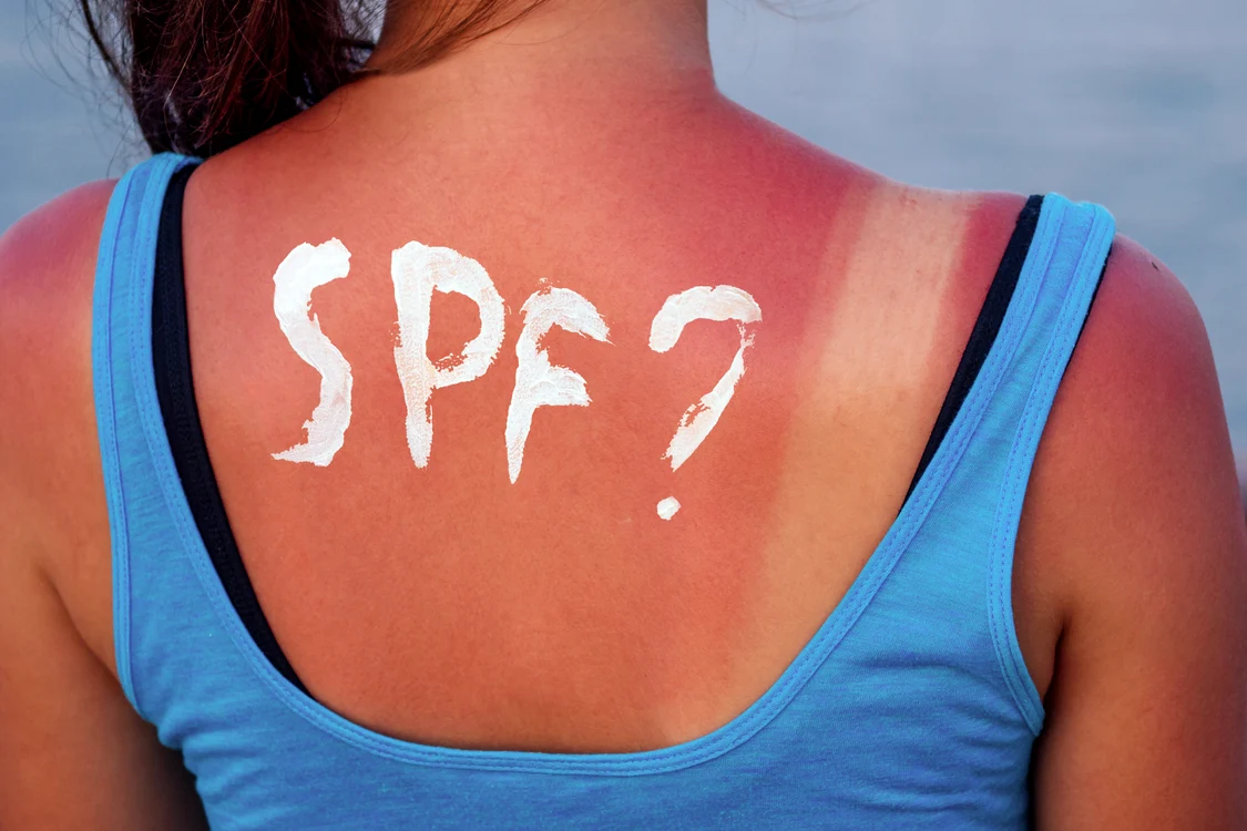 Pentru a preveni arsurile solare, folosiți cremă cu factor de protecție