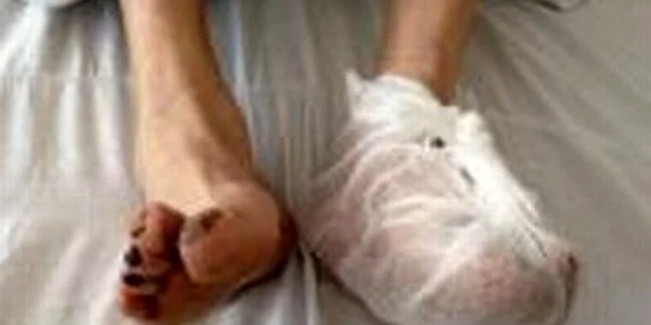 Bărbatul a fost internat la secţia de Terapie Intensivă