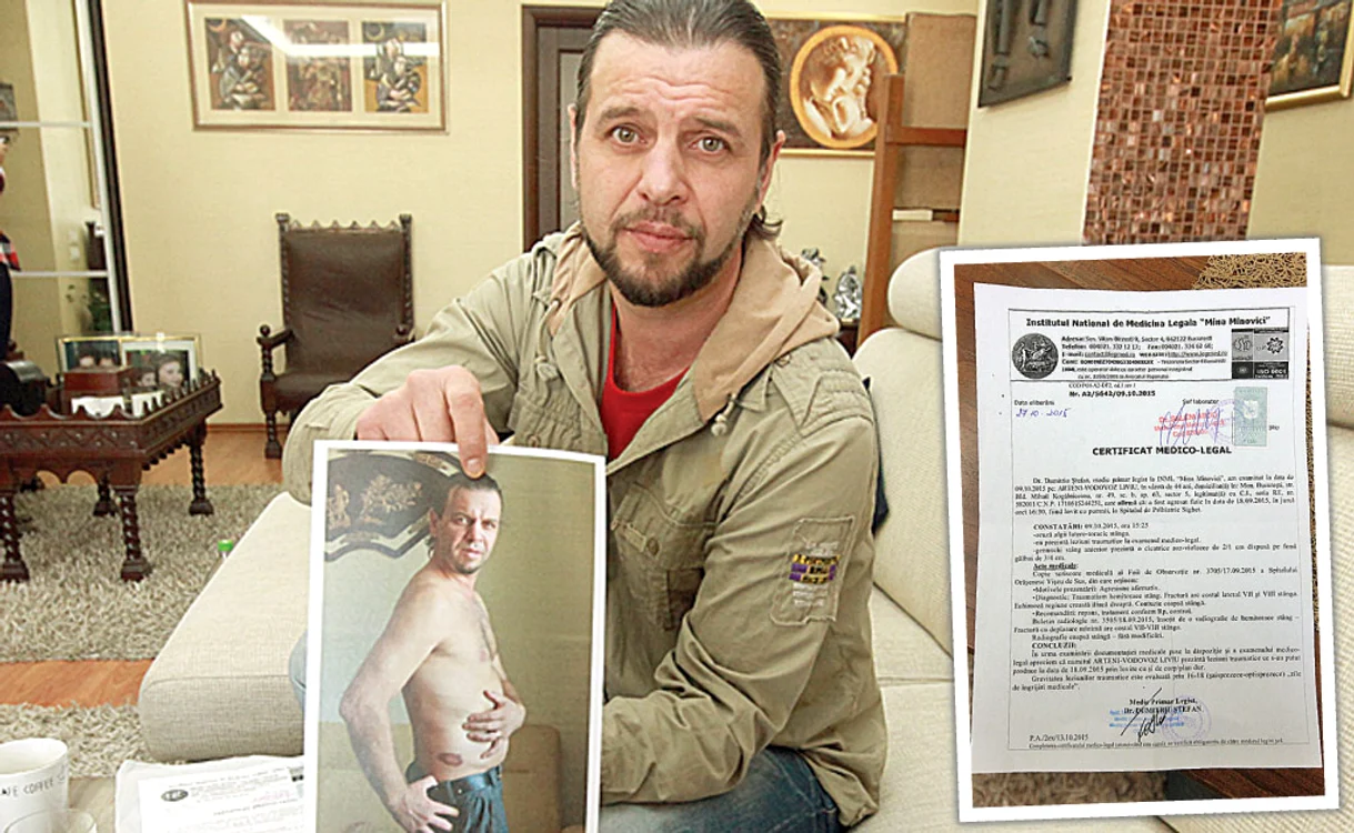 Liviu ne-a arătat atât  vânătăile de pe corp,  făcute, spune el,  de poliţişti, dar şi  certificatul medico-legal
