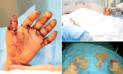 severed hands main jpeg