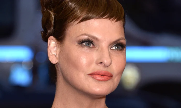 Linga Evangelista  vedete cu botox jpeg